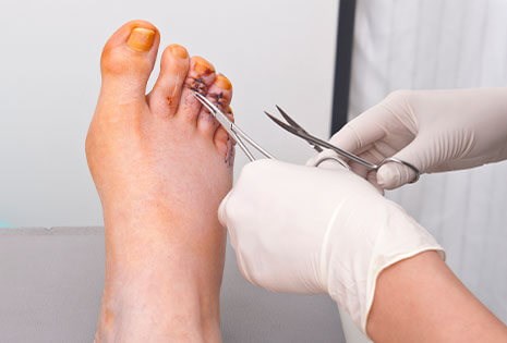 Certified Foot Surgery Facility